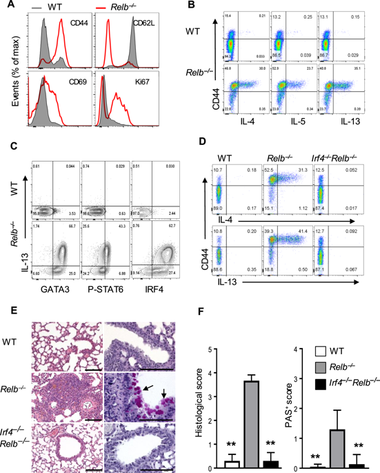 The transcription factor RelB restrains group 2 innate lymphoid cells