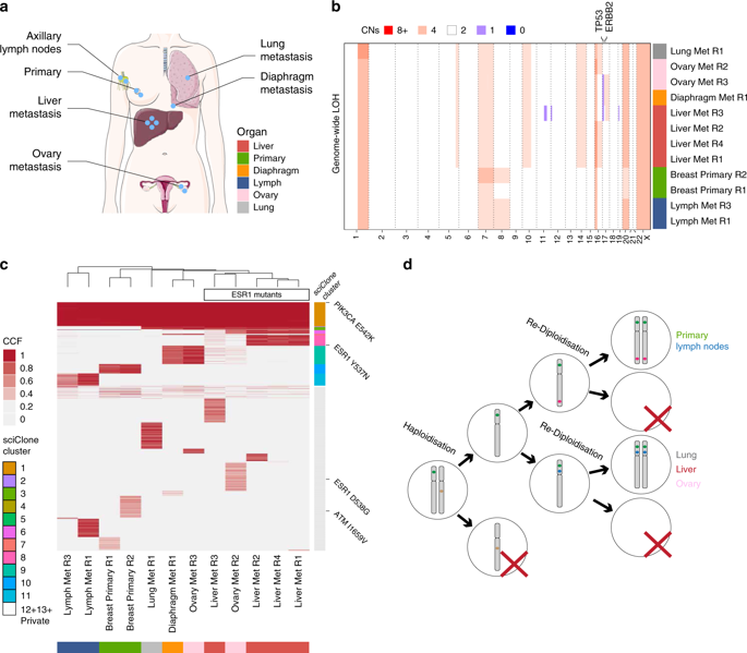 Mapping the breast cancer metastatic cascade onto ctDNA using