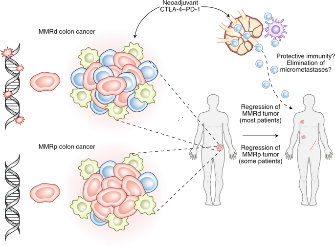 Neoadjuvant Immune-checkpoint Blockade In Resectable Colon Cancer ...