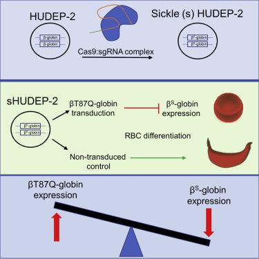 Bt87q Globin Gene Therapy Reduces Sickle Hemoglobin Production Allowing For Ex Vivo Anti Sickling Activity In Human Erythroid Cells Molecular Therapy Methods Clinical Development X Mol