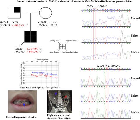 First case report of inherited Rubinstein-Taybi syndrome associated with a  novel EP300 variant, BMC Medical Genetics