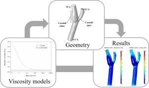 颈动脉血流的结构相互作用研究：粘度模型之间的比较,European Journal Of Mechanics - B/Fluids - X-MOL