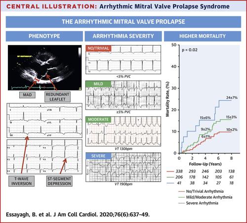 Presentation And Outcome Of Arrhythmic Mitral Valve Prolapse Journal Of The American College Of Cardiology X Mol