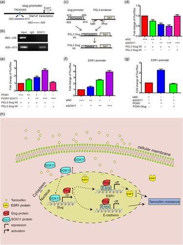 Upregulation of SOX11 enhances tamoxifen resistance and promotes 