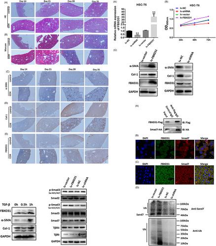 Fbxo31通过促进smad7的泛素化来调节肝星状细胞的活化和肝纤维化 Journal Of Cellular Biochemistry X Mol