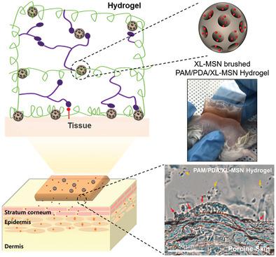 Adhesive Hydrogel Patch with Enhanced Strength and Adhesiveness to Skin ...