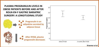 肥胖患者在Roux-en-Y胃减肥手术前后的血浆前颗粒蛋白水平：一项纵向 