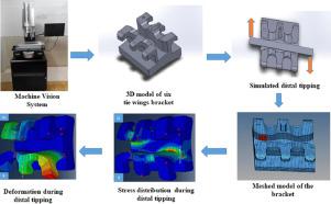 Stress distribution and deformation in six tie wings Orthodontic 