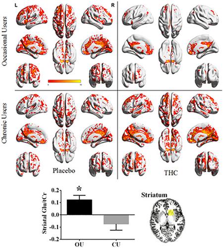 Reduced Responsiveness Of The Reward System Is Associated With Tolerance To Cannabis Impairment In Chronic Users Addiction Biology X Mol