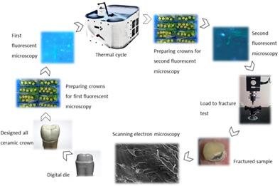 由齿形块和传统块制成的牙冠的断裂载荷和微裂纹比较 Microscopy Research And Technique X Mol