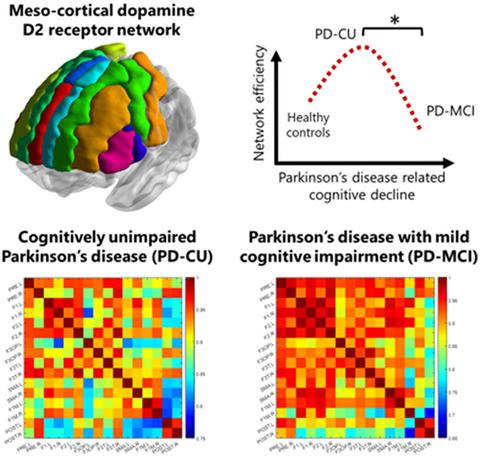 帕金森病认知功能减退患者多巴胺d2受体网络的图论分析 Journal Of Neuroscience Research X Mol