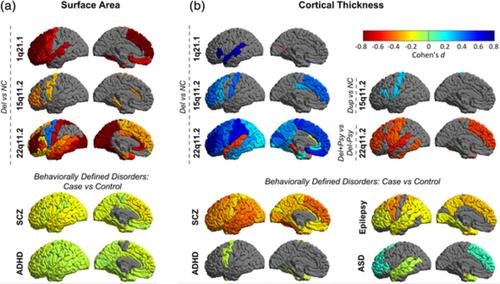 Effects Of Copy Number Variations On Brain Structure And Risk For Psychiatric Illness Large Scale Studies From The Enigma Working Groups On Cnvs Human Brain Mapping X Mol