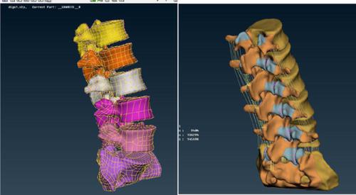 Biomechanical Evaluation of Oblique Lumbar Interbody Fusion with ...