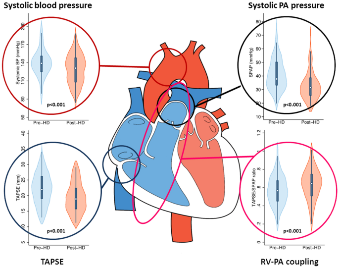 Preload Dependence Of Pulmonary Haemodynamics And Right Ventricular Performance Clinical Research In Cardiology X Mol