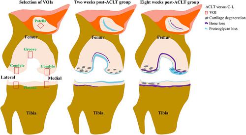 创伤后骨关节炎兔模型中骨软骨组织的早期变化 Journal Of Orthopaedic Research X Mol