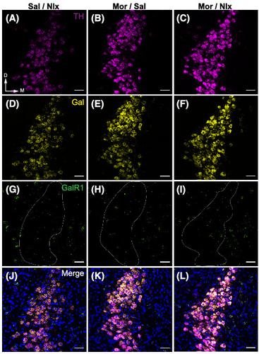 Cell Type Specific Expression And Behavioral Impact Of Galanin And Galr1 In The Locus Coeruleus During Opioid Withdrawal Addiction Biology X Mol