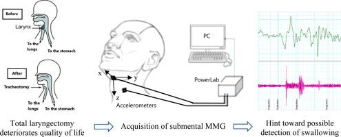 Submental Mechanomyography Mmg To Characterize The Swallowing Signature Irbm X Mol