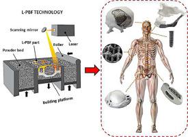 Additive Manufacturing Of Metallic And Polymeric Load-bearing ...