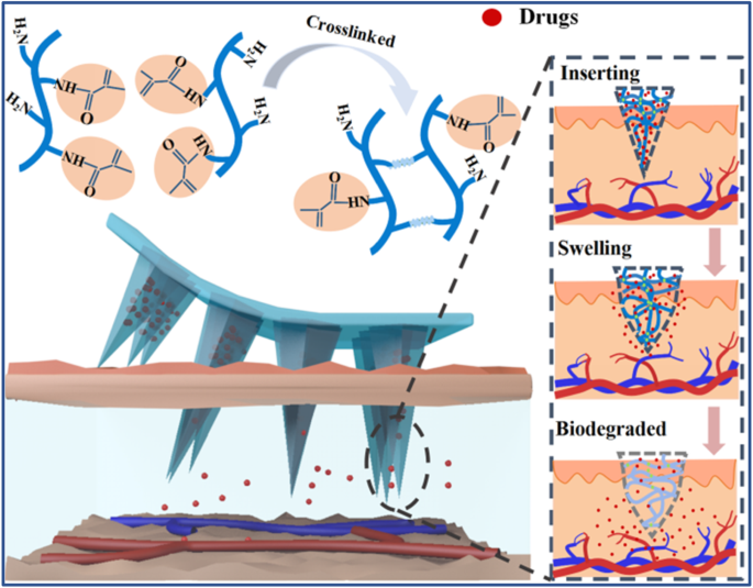 Fabrication Of Gelatin Methacryloyl Hydrogel Microneedles For ...