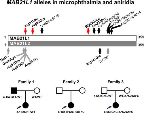 小眼症和无虹膜中错义mab21l1 变异体的鉴定 Human Mutation X Mol