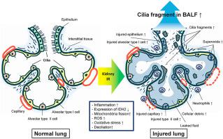 急性肾损伤后的氧化应激会导致肺细胞纤毛破裂 并将其释放到支气管肺泡灌洗液中 并导致肺损伤 而idh2 缺失会加剧这种情况 Redox Biology X Mol