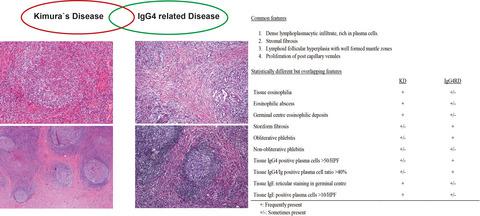 木村病与igg4 相关疾病的比较研究 异同和重叠特征 Histopathology X Mol