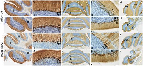脊髓小脑共济失调1 ATXN1[82Q]小鼠模型中浦肯野细胞形态和运动行为的 