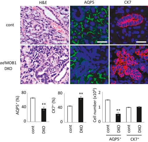 TAZ抑制腺泡细胞分化但促进成年小鼠唾液腺中未成熟的导管细胞增殖 