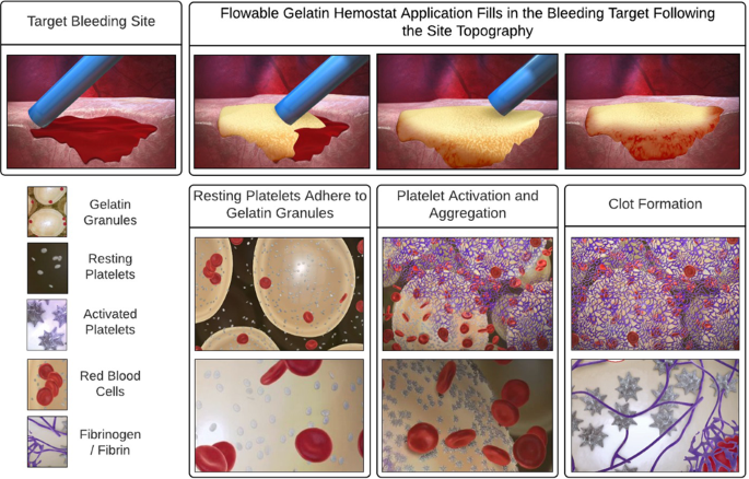 Hemostatic Efficacy Of Two Topical Adjunctive Hemostats In A Porcine