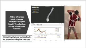 一种新的可穿戴拉伸传感器阵列，用于治疗运动期间的3D 脊柱模型可视化 