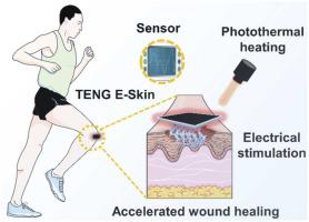 用于加速伤口愈合的自供电和光热电子皮肤贴片,Nano Energy - X-MOL