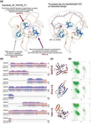 A Novel Frameshift Mutation Of DVL1-induced Robinow Syndrome: A Case ...