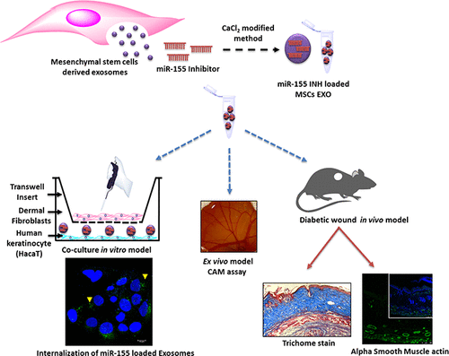 Mesenchymal Stem Cell-Derived Exosomes Loaded With MiR-155 Inhibitor ...