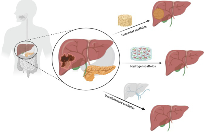 用于肝脏再生的天然支架：叙述更新,Stem Cell Reviews and Reports - X-MOL