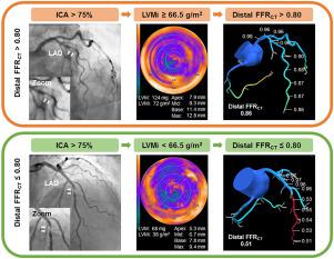 Effects Of Left Ventricular Mass On Computed Tomography Derived Fractional Flow Reserve In Significant Obstructive Coronary Artery Disease International Journal Of Cardiology X Mol