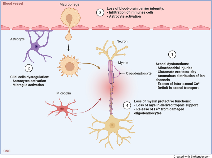 A Narrative Review on Axonal Neuroprotection in Multiple Sclerosis ...