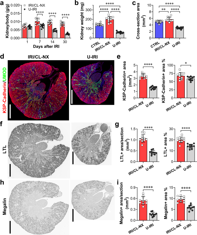 Immune Mediated Tubule Atrophy Promotes Acute Kidney Injury To Chronic