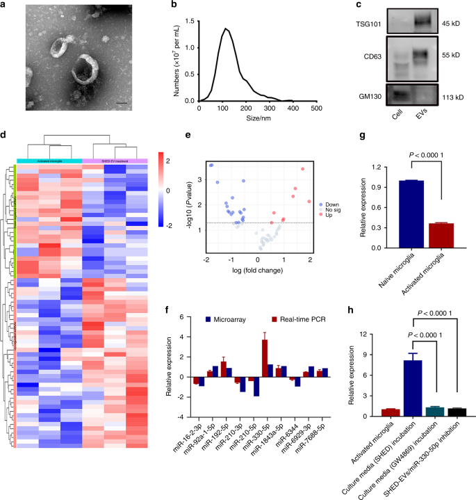 Dental stem cell-derived extracellular vesicles transfer miR-330