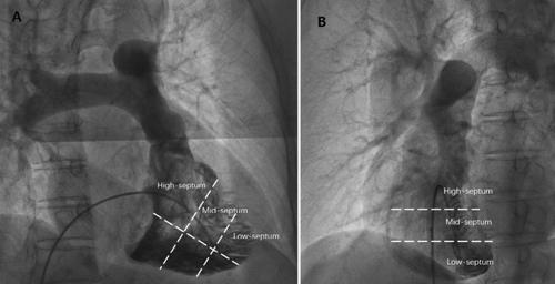 Cardiac and Vascular Imaging - Cardiac - Western University