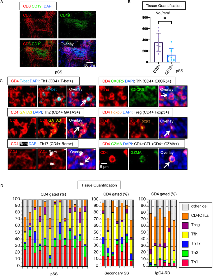 细胞毒性CD8+ T 细胞可能是干燥综合征组织破坏的驱动因素,Scientific 