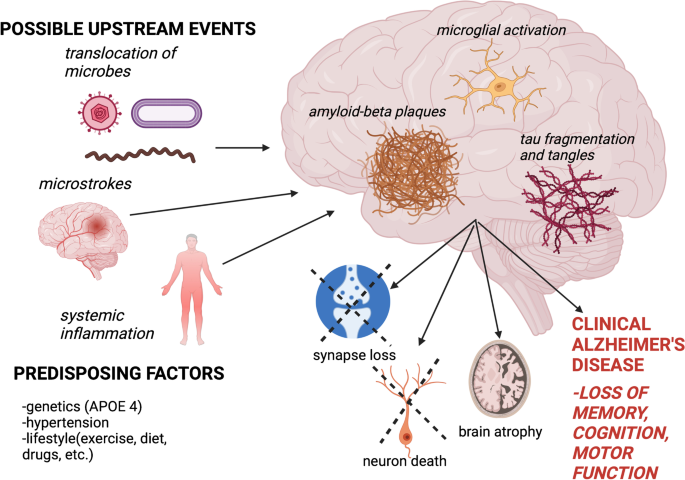 The Link Between Periodontitis And Alzheimer’s Disease: Reality Or Yet ...