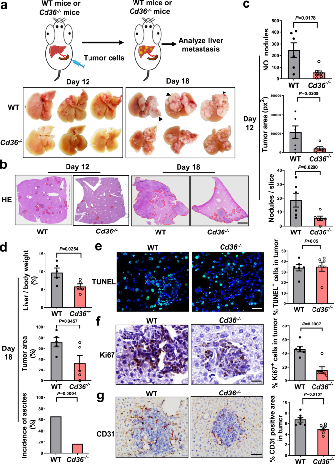 Cd36 Mediated Metabolic Crosstalk Between Tumor Cells And Macrophages Affects Liver Metastasis