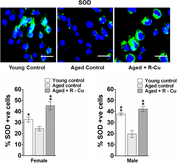 A pro-oxidant combination of resveratrol and copper down-regulates