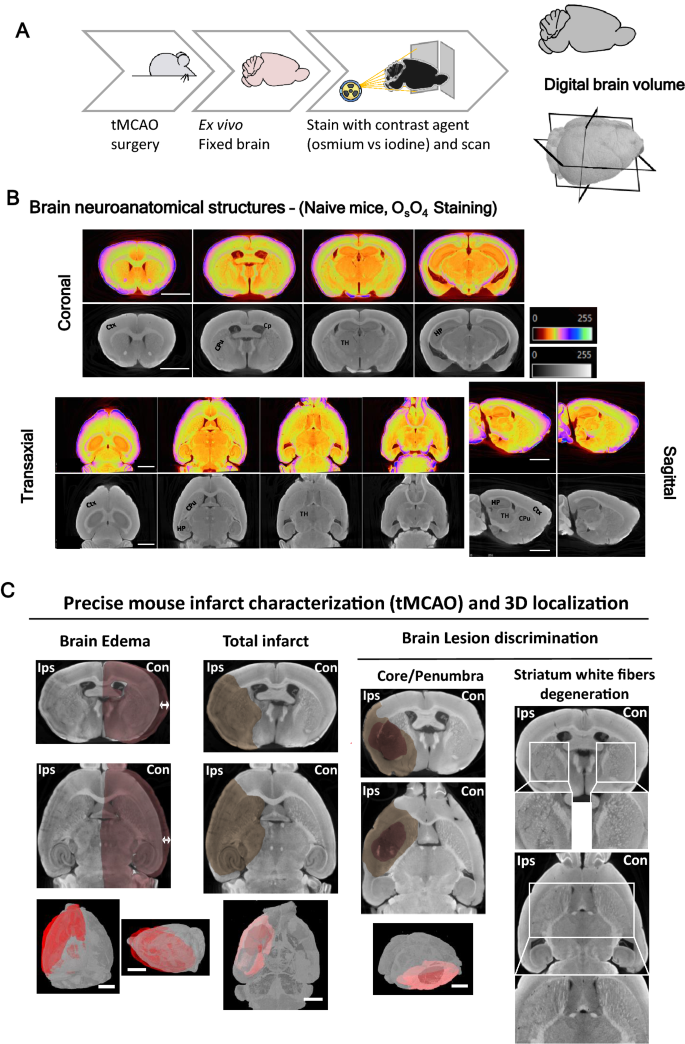 用于小鼠中风模型3D 梗塞表征和分割的高分辨率显微CT,Scientific 