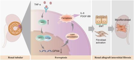 IRF1/ZNF350/GPX4介导的肾小管上皮细胞铁死亡促进慢性同种异体移植肾间 