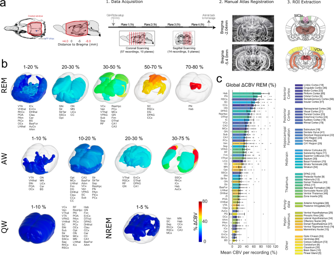 Global dissociation of the posterior amygdala from the rest of the