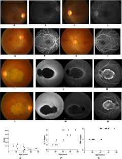 Phenotypic characterization of autosomal dominant progressive cone ...