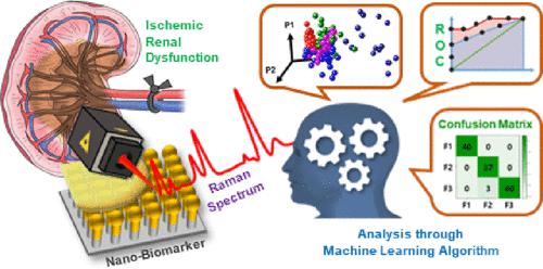 使用表面增强拉曼光谱和机器学习算法诊断缺血性肾功能衰竭,Analytical