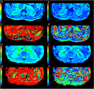 Intravoxel Incoherent Motion Diffusion-weighted MRI Of Renal Parenchyma ...