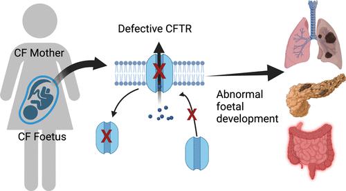 In Utero Mapping And Development Role Of CFTR In Lung And ...